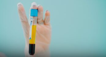 ¡Se puede tratar la COVID-19 con derivado de plasma!